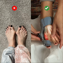 Avyroa BunionFix adjustable night toe corrector for bunion discomfort