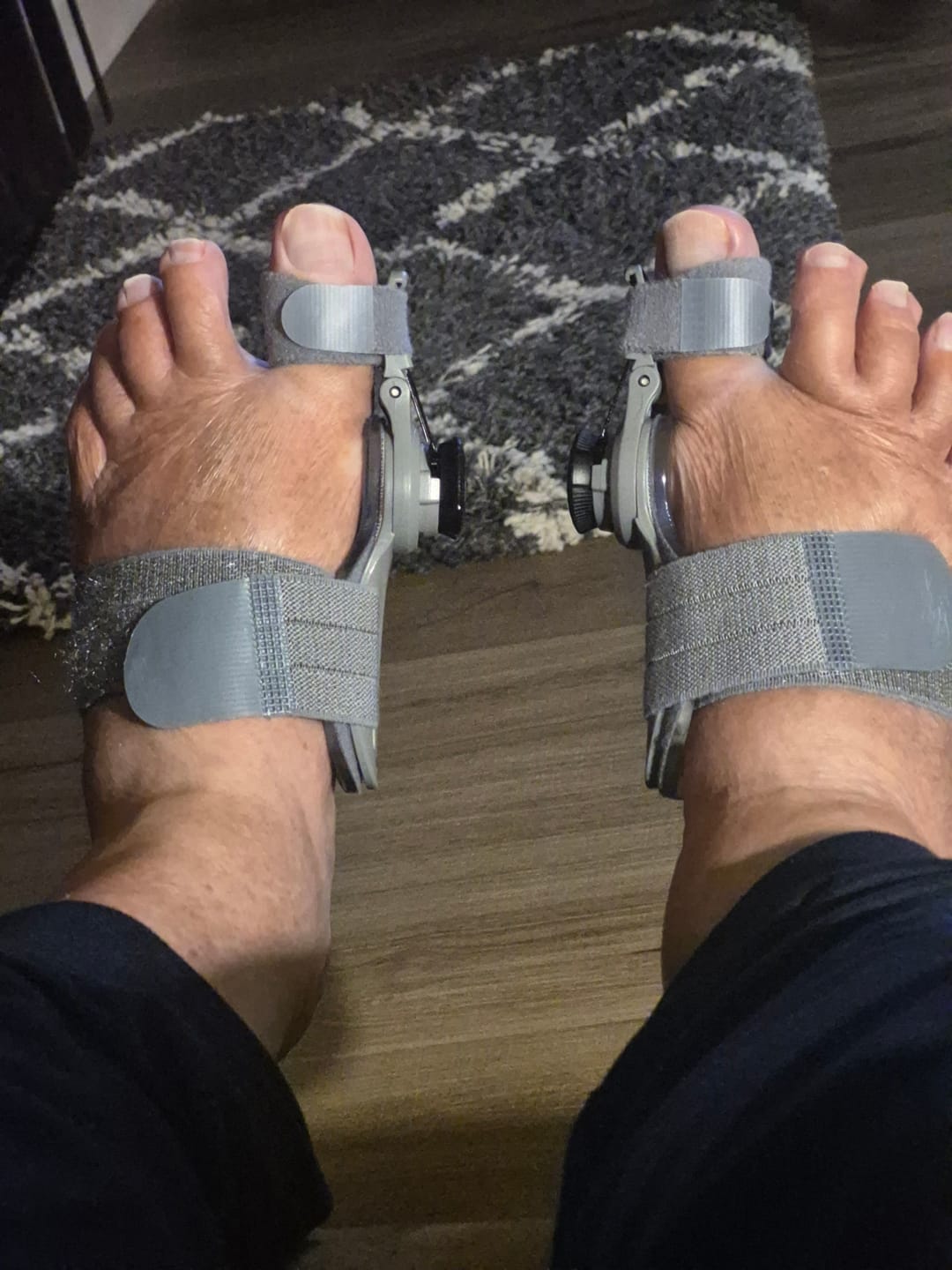 Customer wearing bunion corrector at night